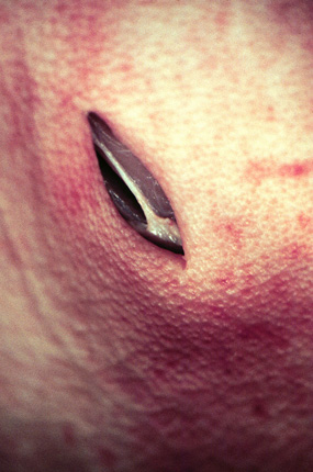 cut